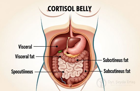 Kortizol Göbeği Nedir? Stresle Gelen Karın Ya..