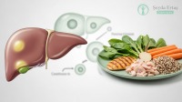 Fatty Liver Diet: Foods to Eat and Avoid in 2026