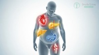 12 Dangers of Rapid Weight Gain: A Dietitian's Guide for 2026